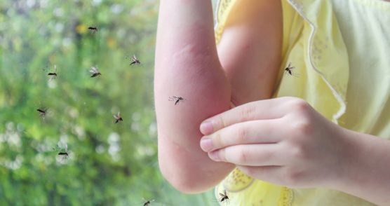 Ako sa zbaviť komárov?